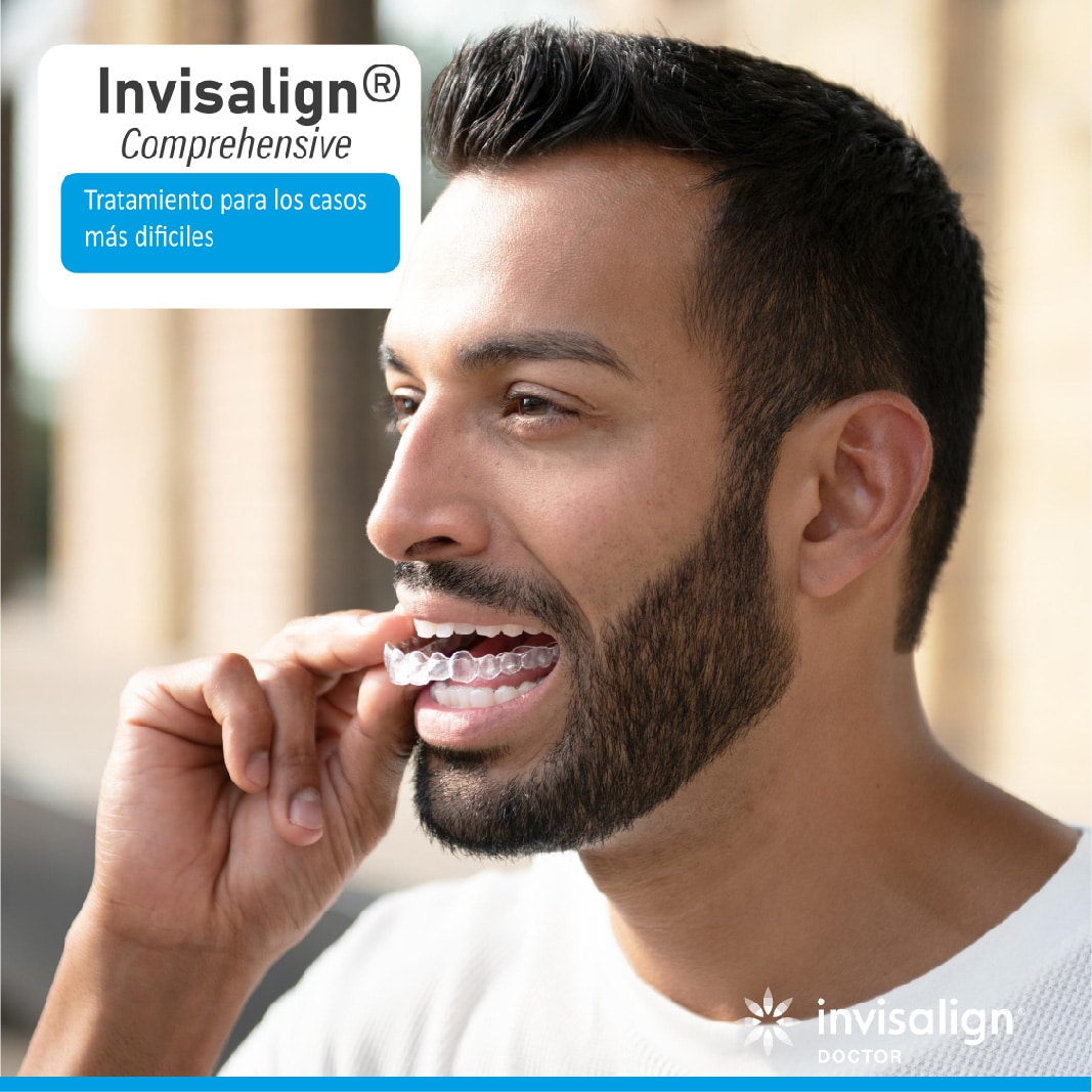 Invisalign Comprehensive: cuándo lo necesitas