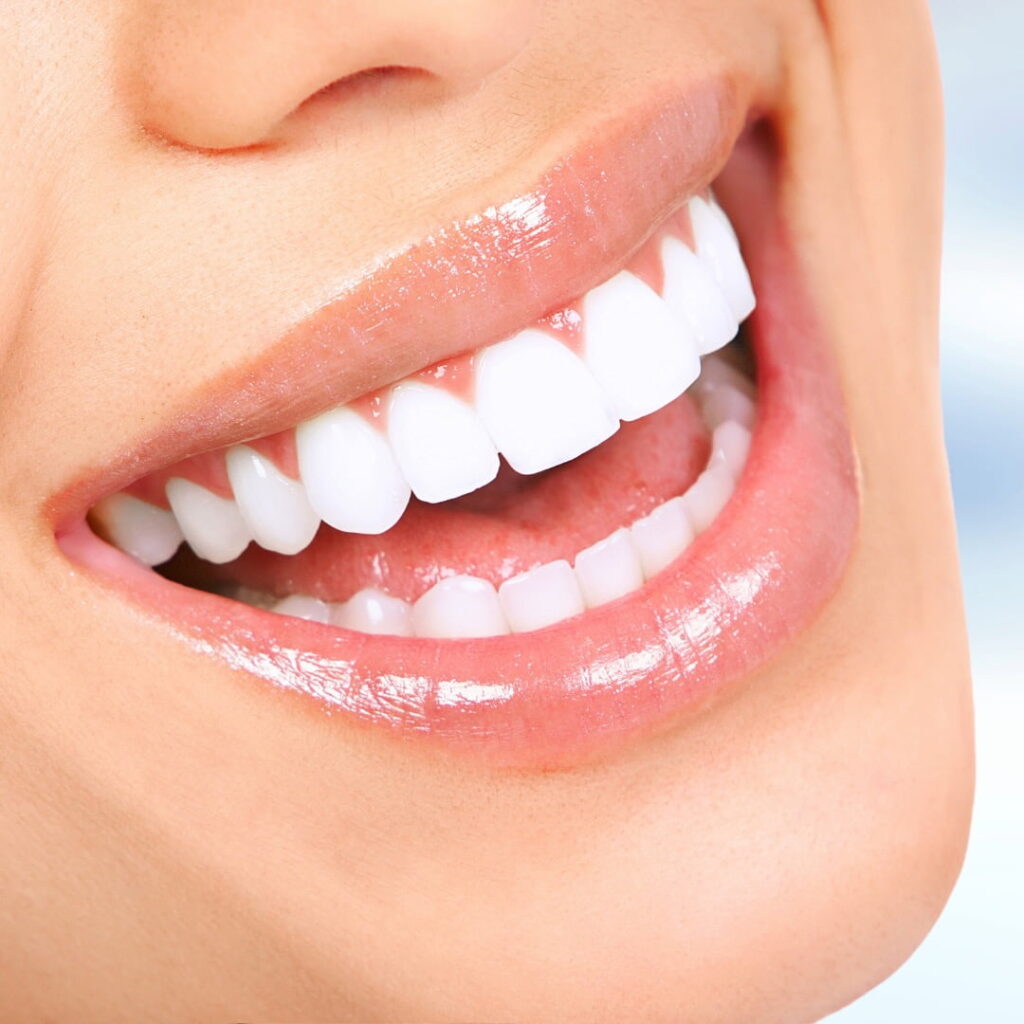 Dise&ntilde;o de sonrisa