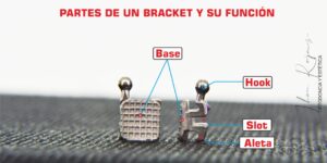 Partes de un bracket