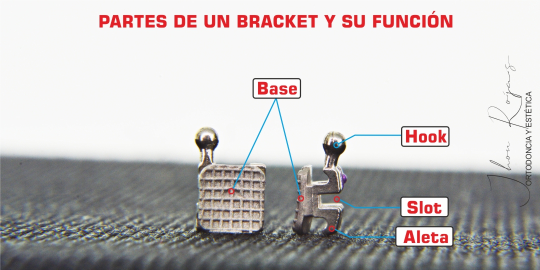 Partes de los Brackets