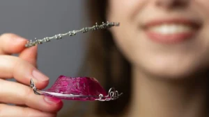 Imagen de Retiro de brackets