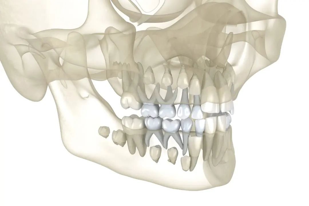 Dientes de leche