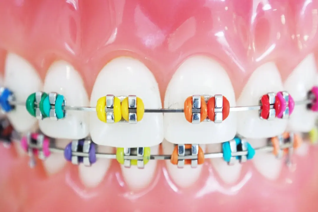 colores de brackets