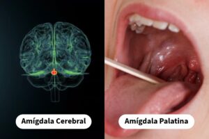 Amígdalas