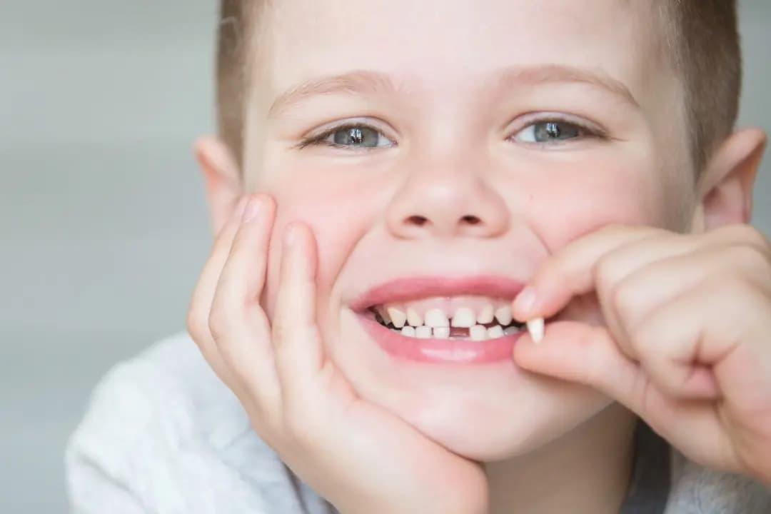 Dientes de Leche – Qué son, función cuándo salen, y síntomas