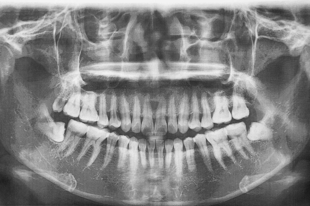 Radiografias dentales