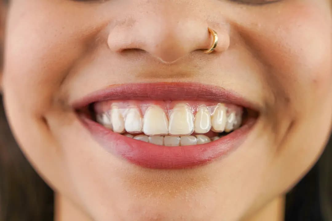 Brackets Invisibles